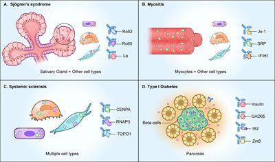 Autoantibodies Targeting Intracellular and Extracellular Proteins in Autoimmunity